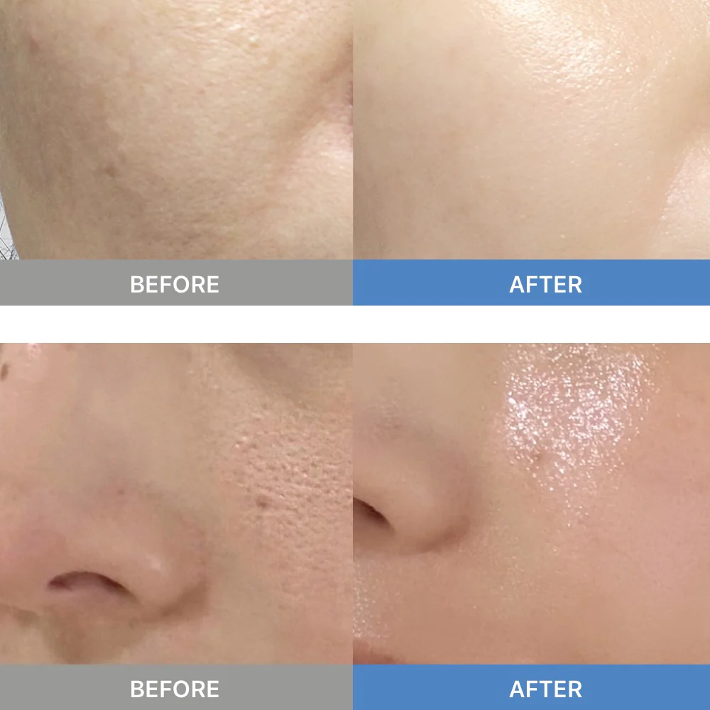 Sunnicorn Microbiome Collagen Mask - Image 7