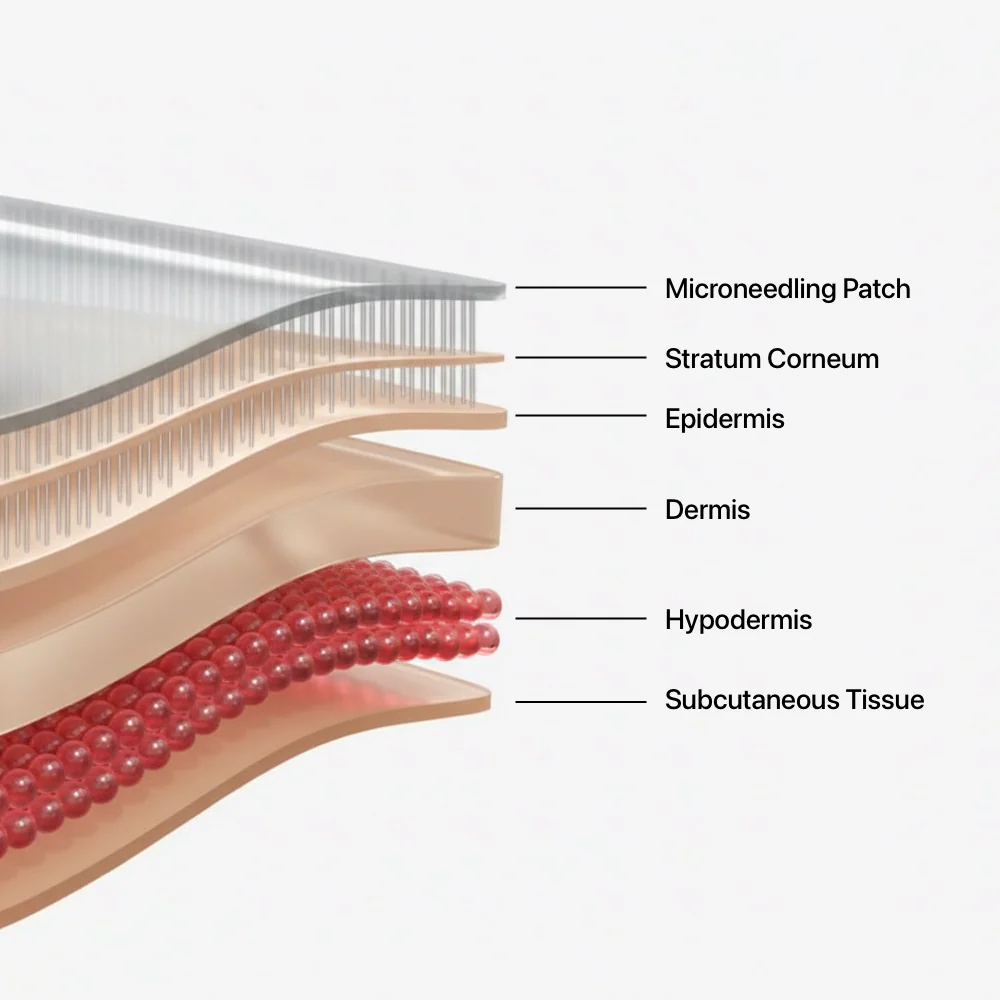 Sonagi Microneedle Patches - Image 8